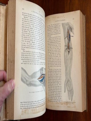 A TEXT-BOOK ON SURGERY. General, Operative and Mechanical.