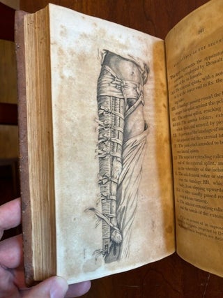 A Treatise on Fractures, Luxations and Other Affections of the Bones. Wherein His Opinions and Practice, in Such Cases, are Stated and Exemplified. Edited by Xav[ier]. Bichat. Translated . by Charles Caldwell with Notes and an Appendix Containing Several Late Improvements in Surgery.
